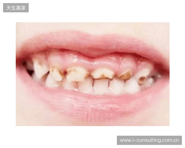 韦林顿确诊上唇部贯通伤;11、21牙半脱位;上颌前牙区牙槽骨骨折